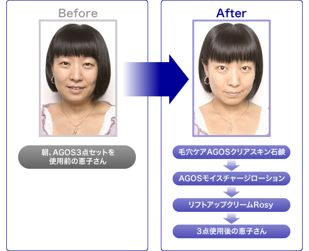 Before,after比較イメージ