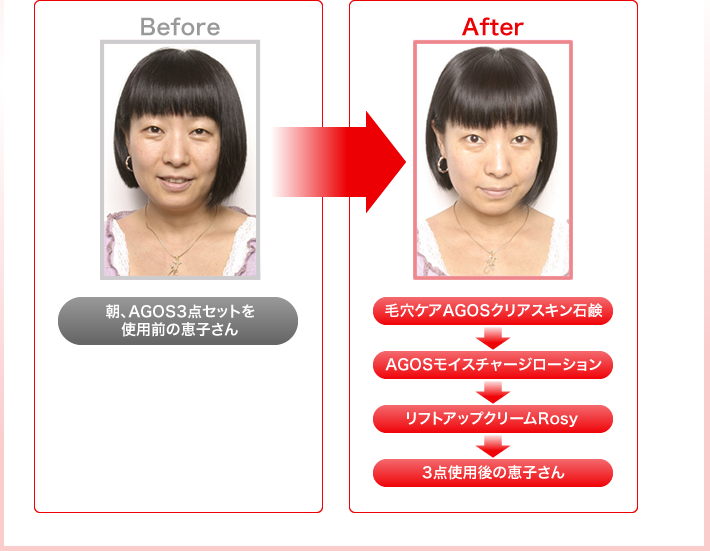 Before,after比較イメージ